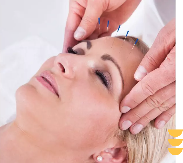 A woman getting her face waxed by an acupuncturist.